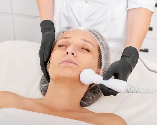 Laser Hair Removal Image