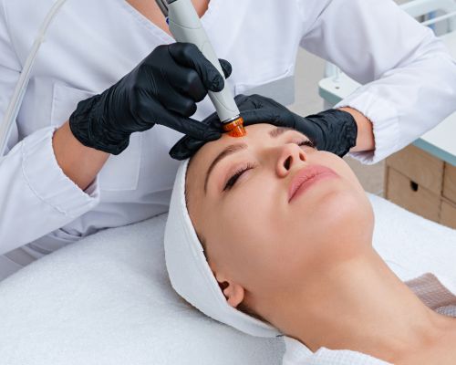 Laser Hair Removal Image