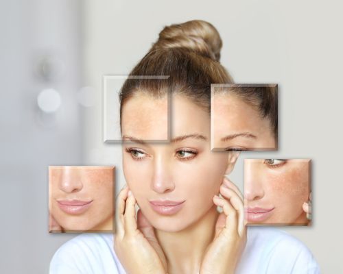 Laser Hair Removal Image