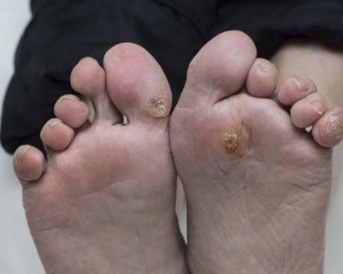 Laser Hair Removal Image