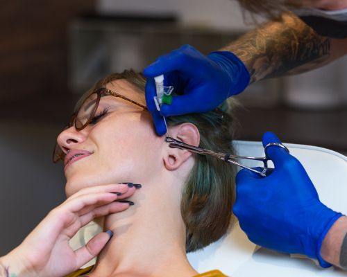 Laser Hair Removal Image