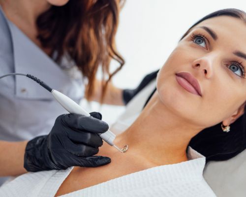 Laser Hair Removal Image