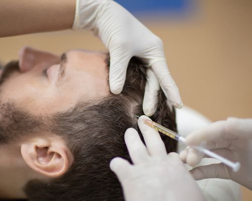 Laser Skin Tightening